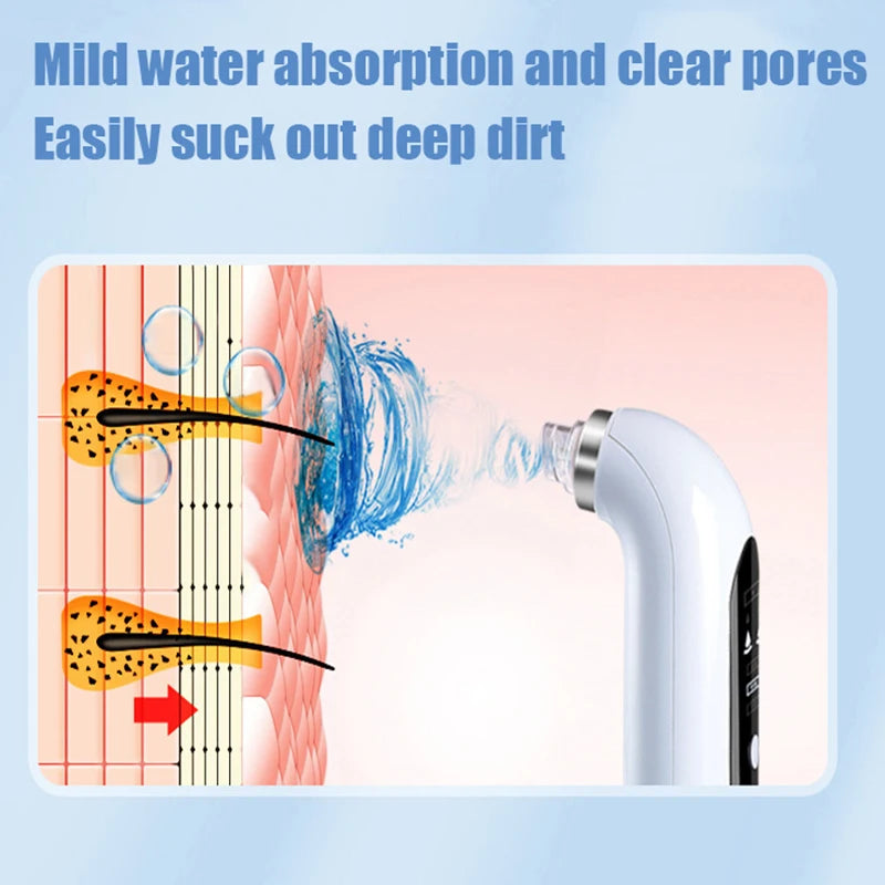 Blackhead remover vacuum device