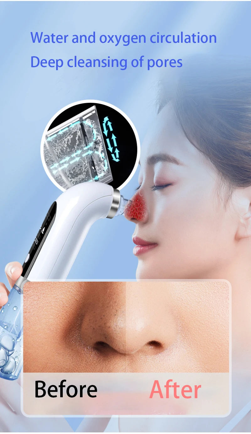 Blackhead remover vacuum device