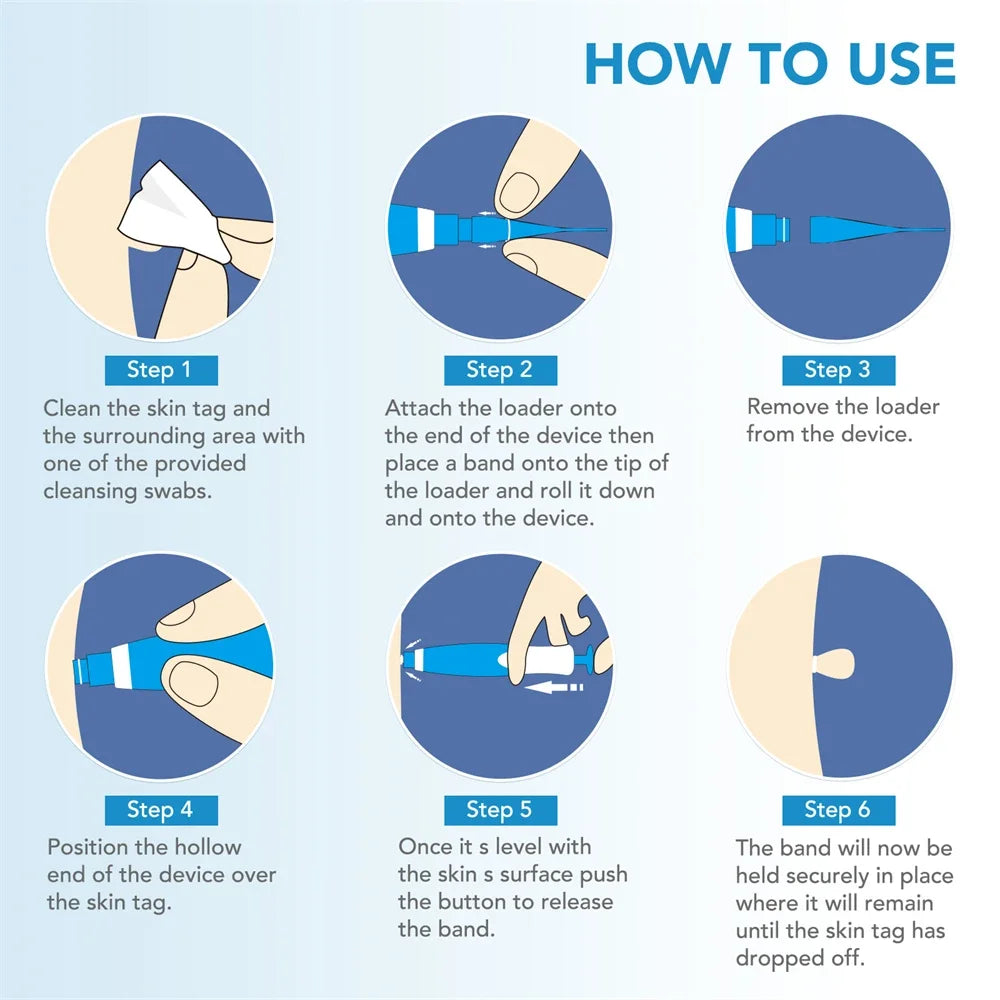 Pimple Remover tool