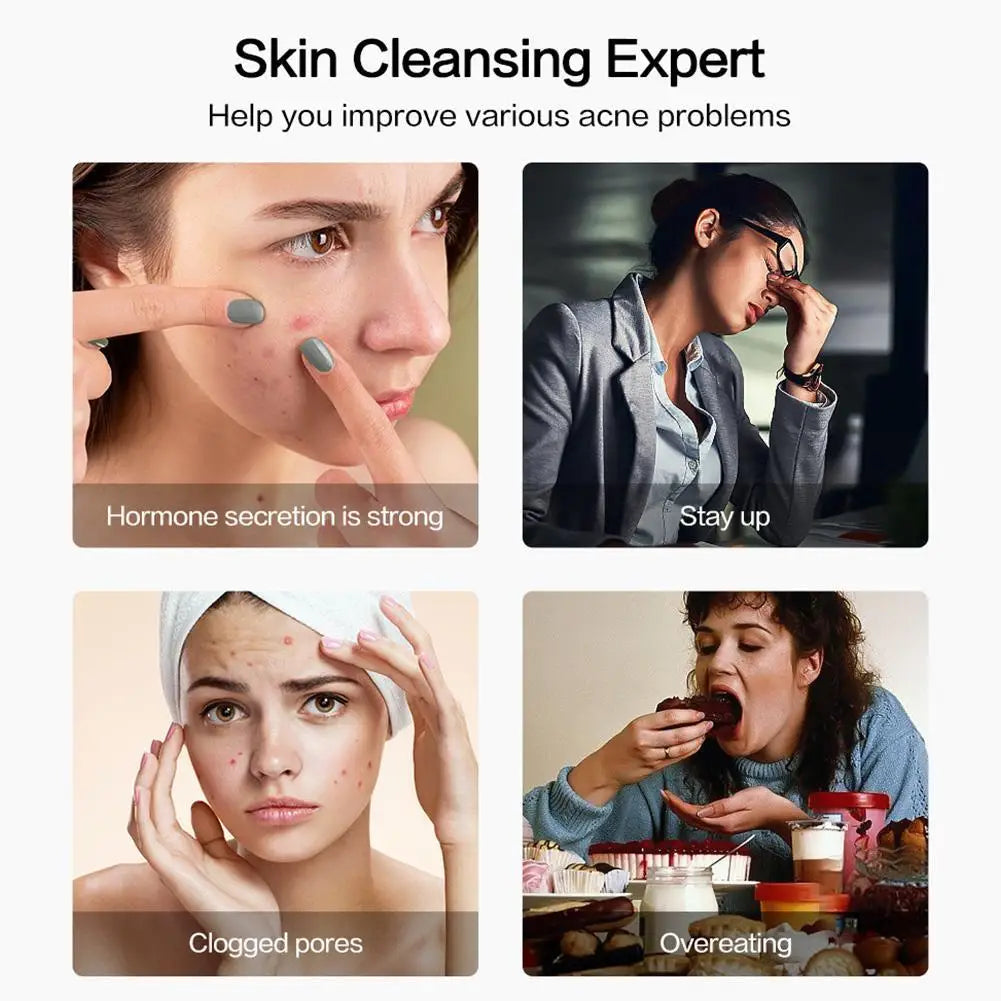 Smart visual pimple popper with camera