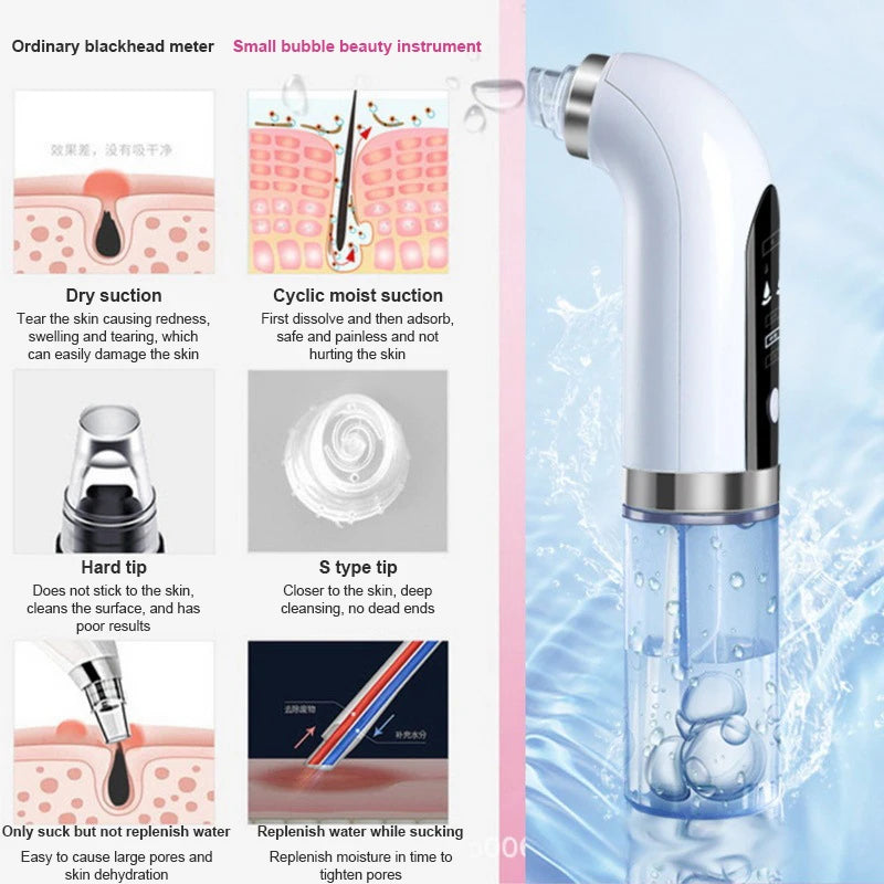 Blackhead remover vacuum device