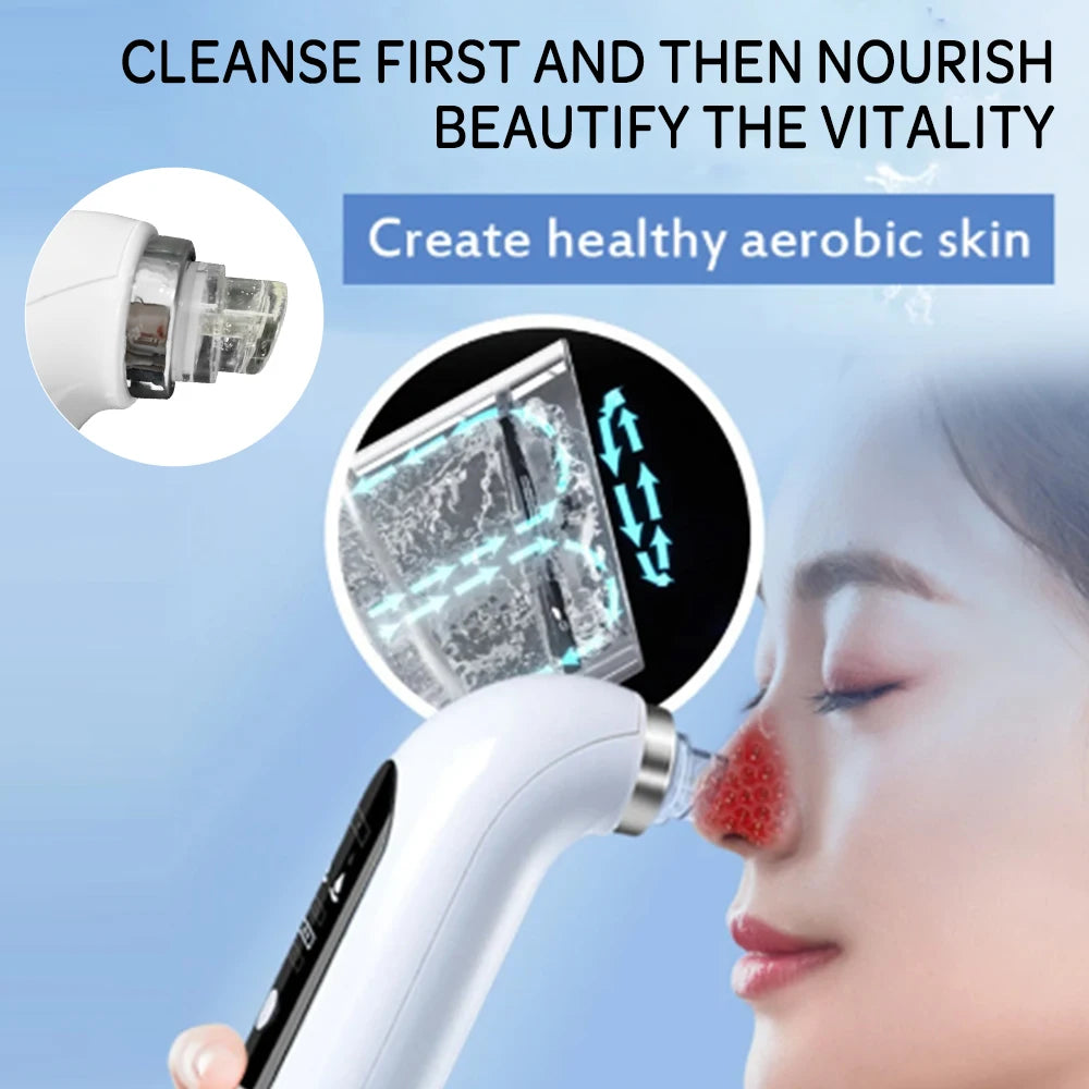 Blackhead remover vacuum device