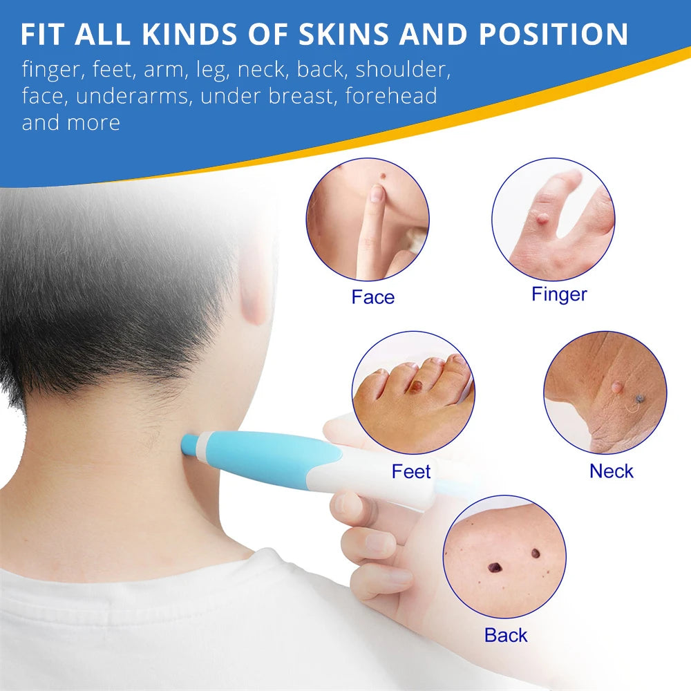 Pimple Remover tool