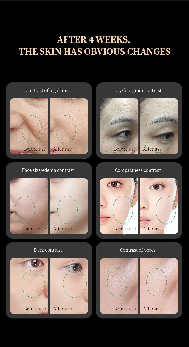 Smart red light therapy collagen booster face tool