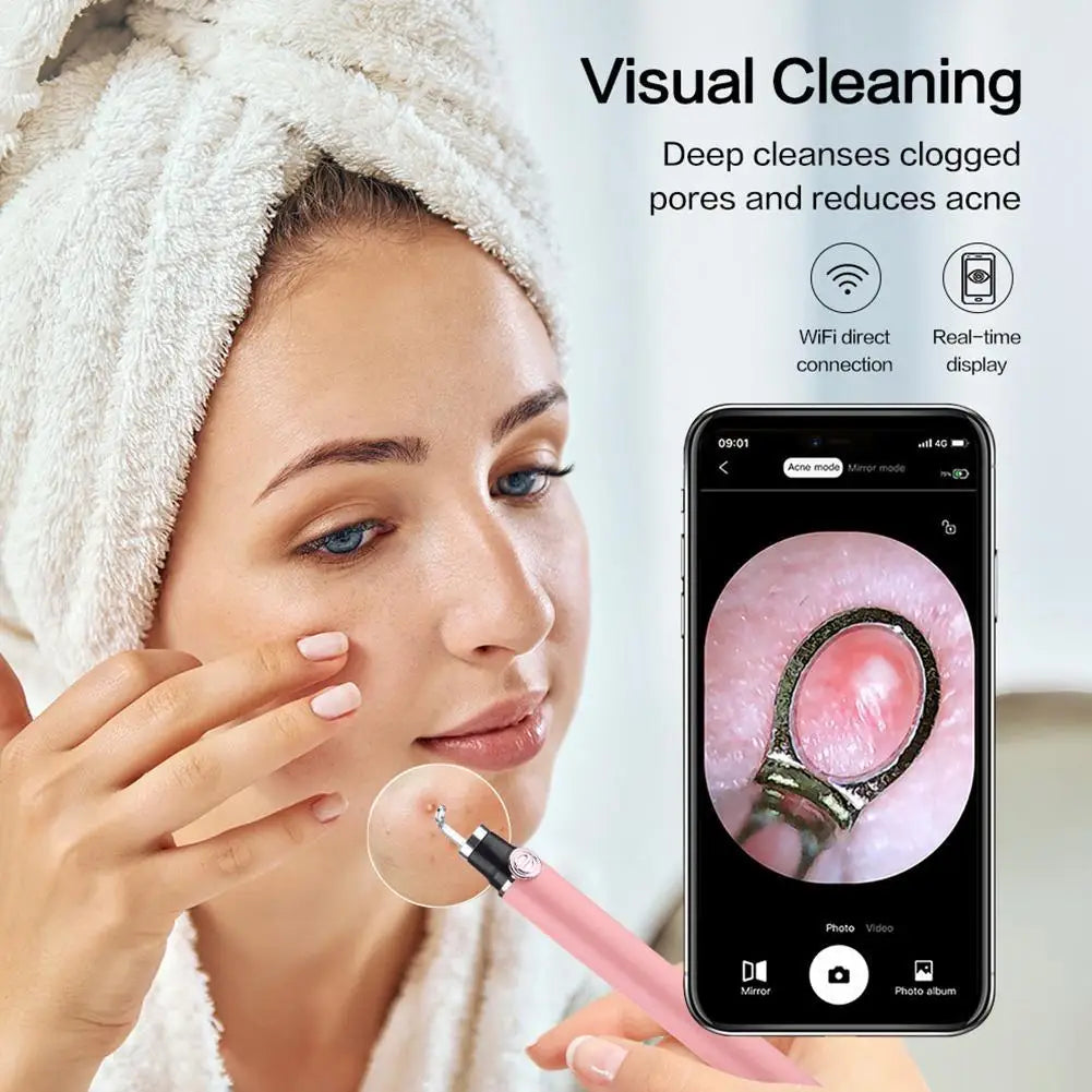 Smart visual pimple popper with camera