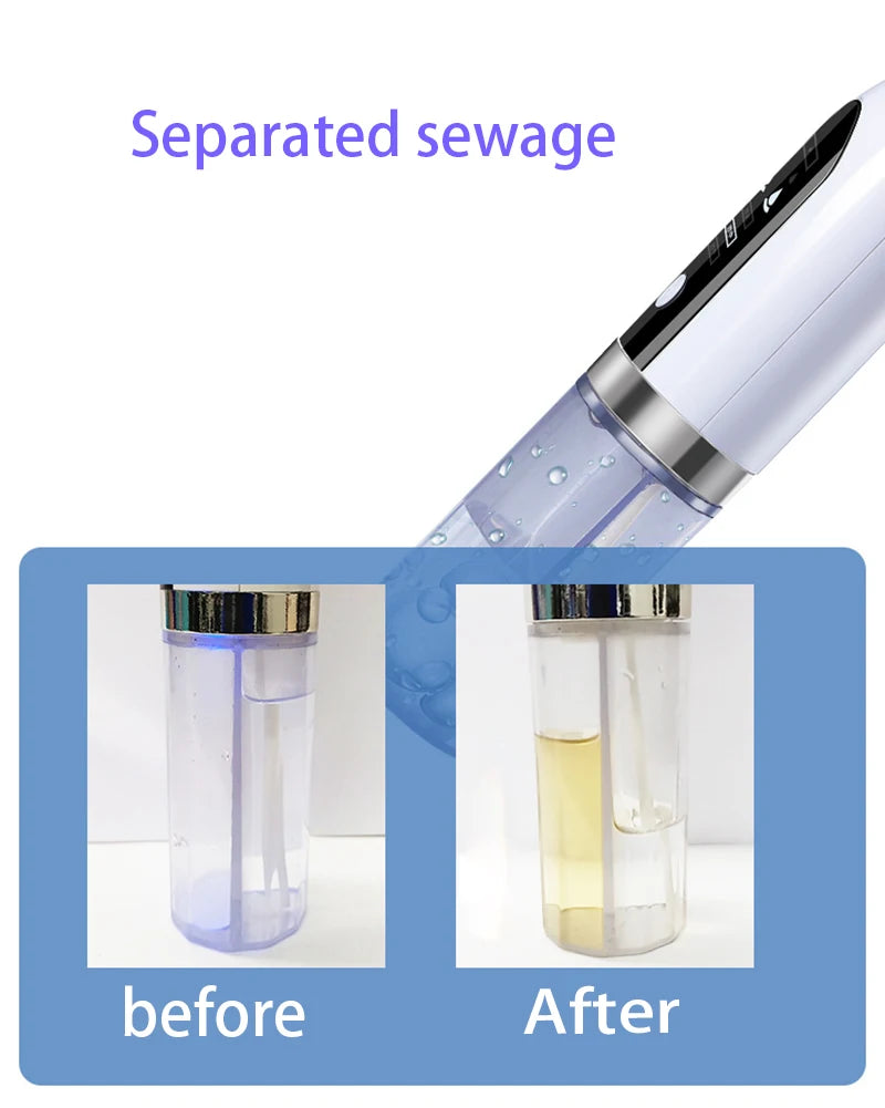 Blackhead remover vacuum device