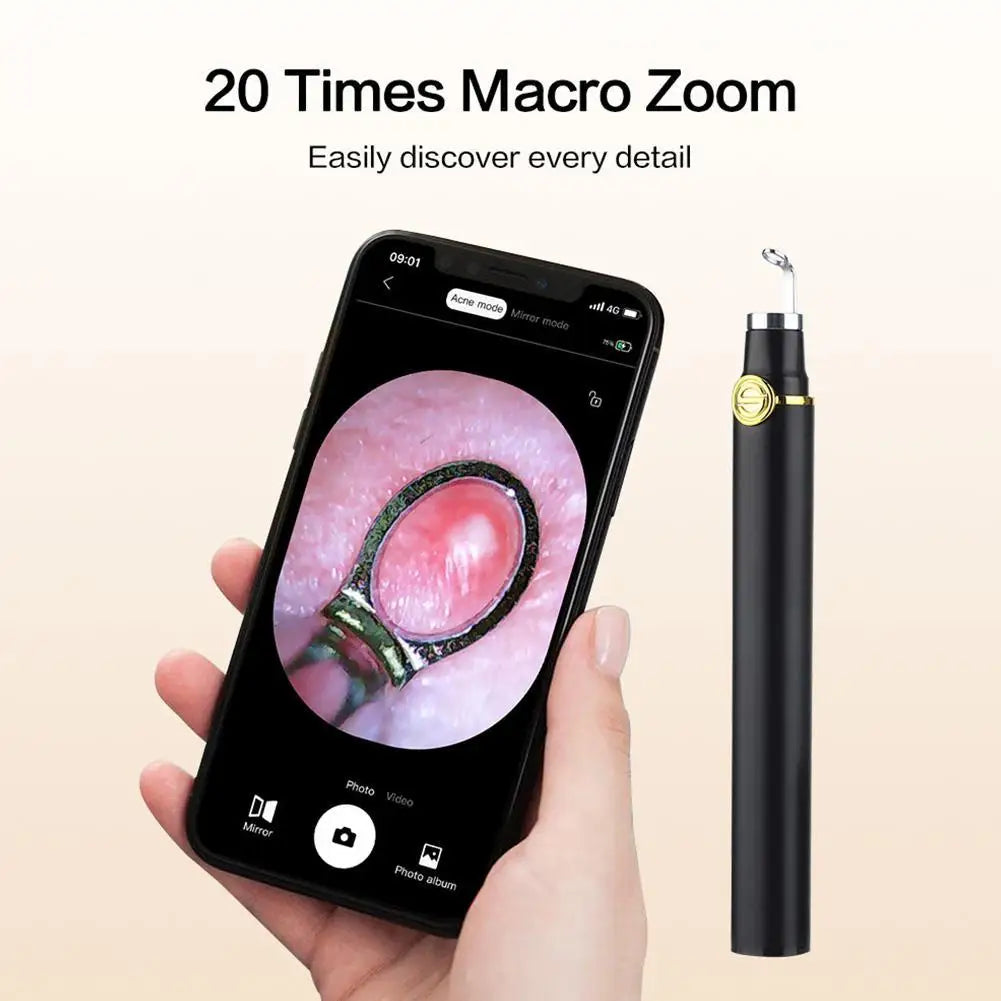 Smart visual pimple popper with camera