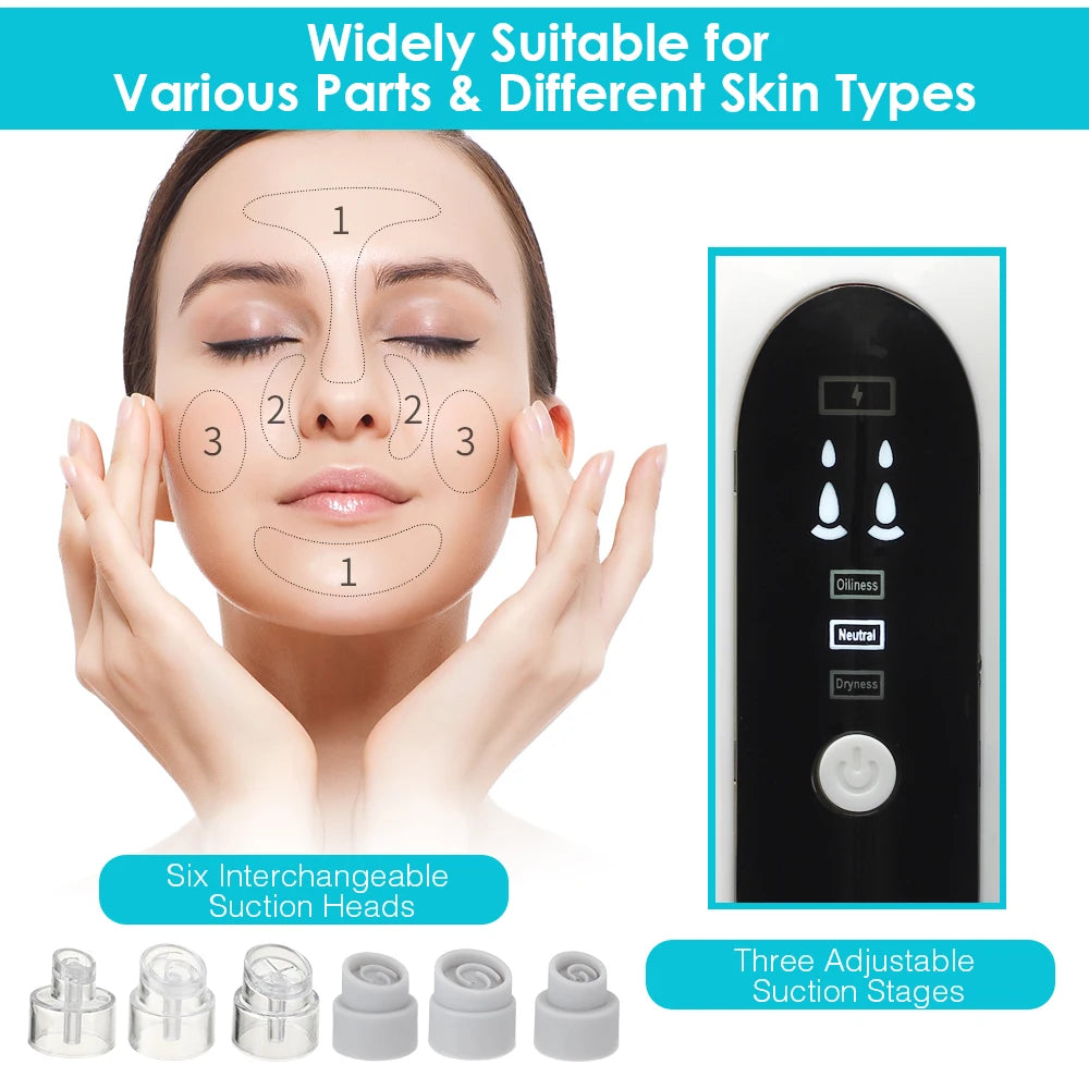 Blackhead remover vacuum device