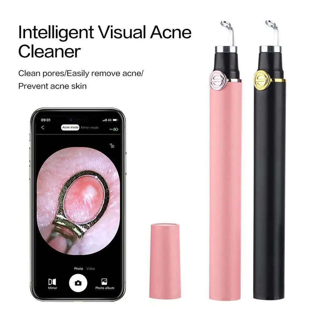 Smart visual pimple popper with camera