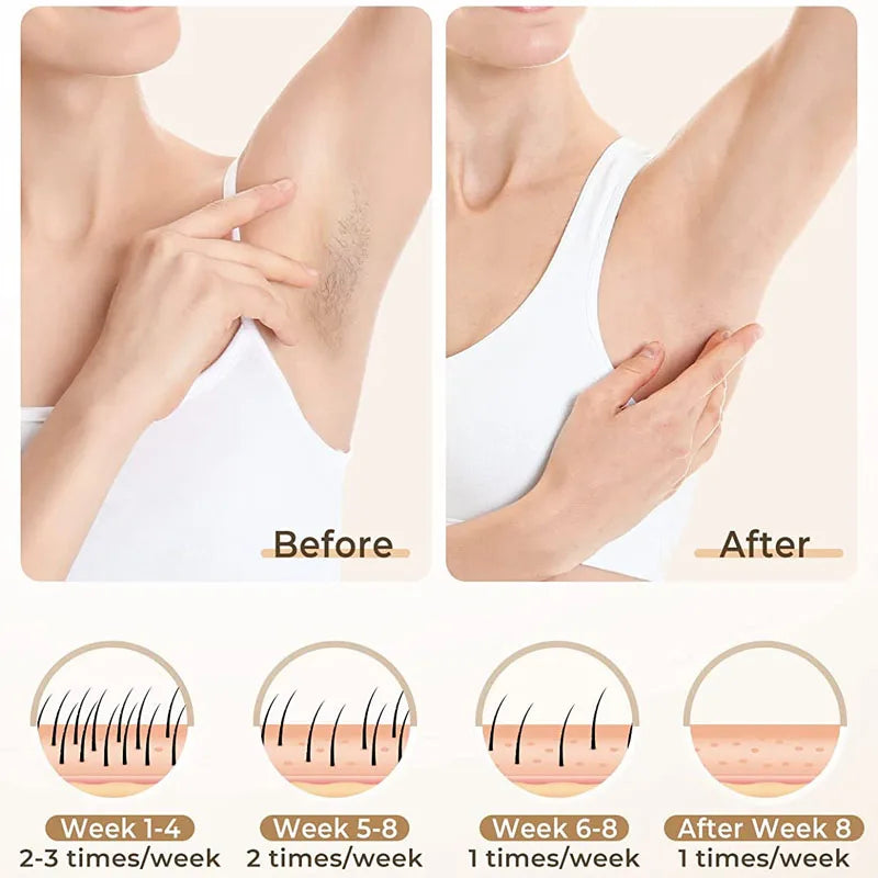 Lumea Hair Removal Device
