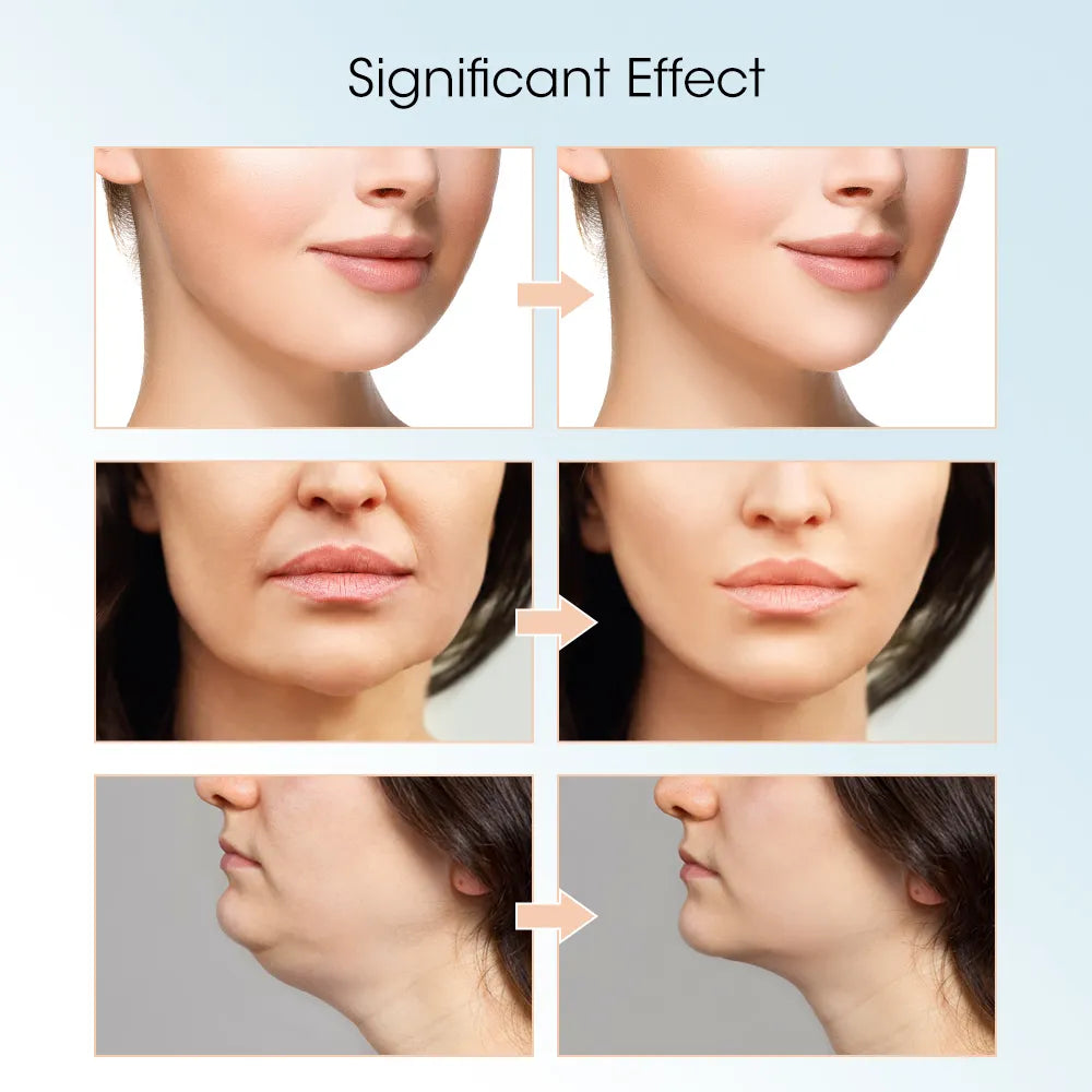 Electric face lift massager