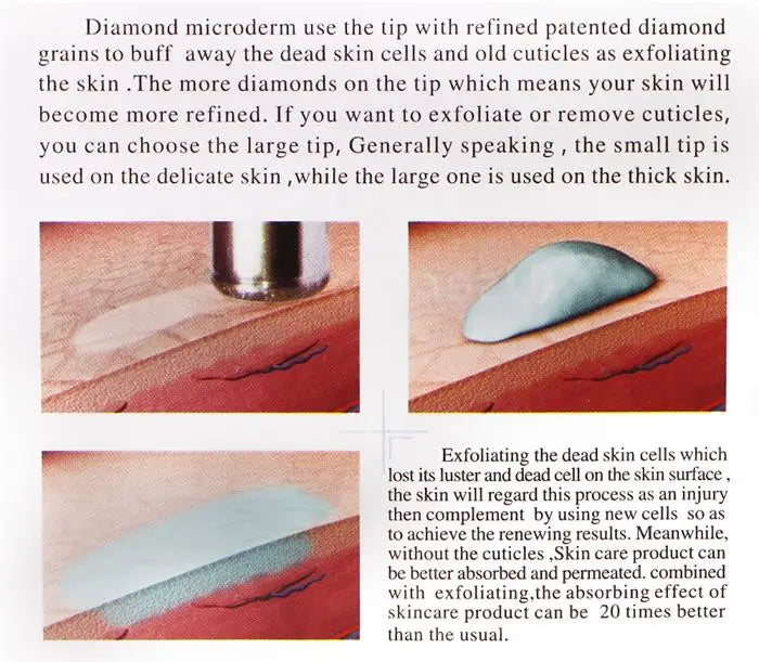 Handheld smart microdermabrasion
