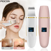 Ultrasonic Electric skin scrubber
