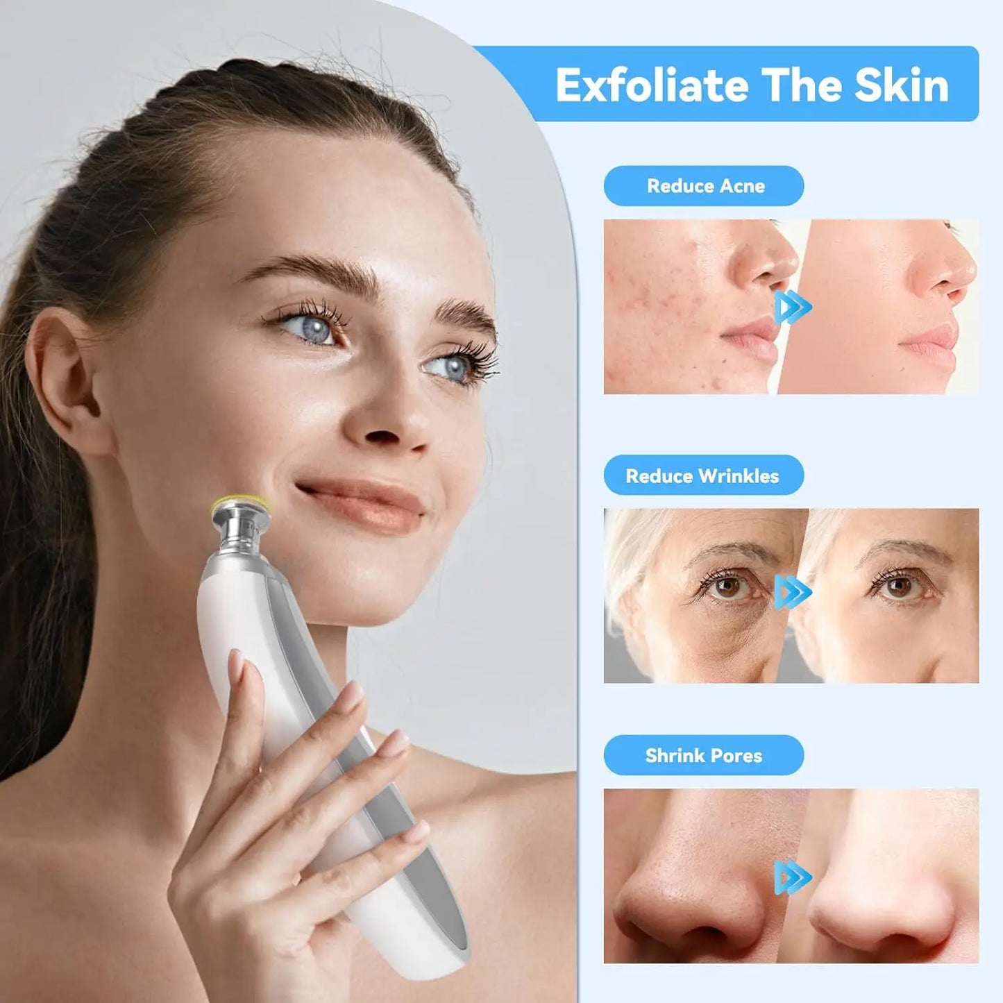 2 in 1 Microdermabrasion blackhead remover device