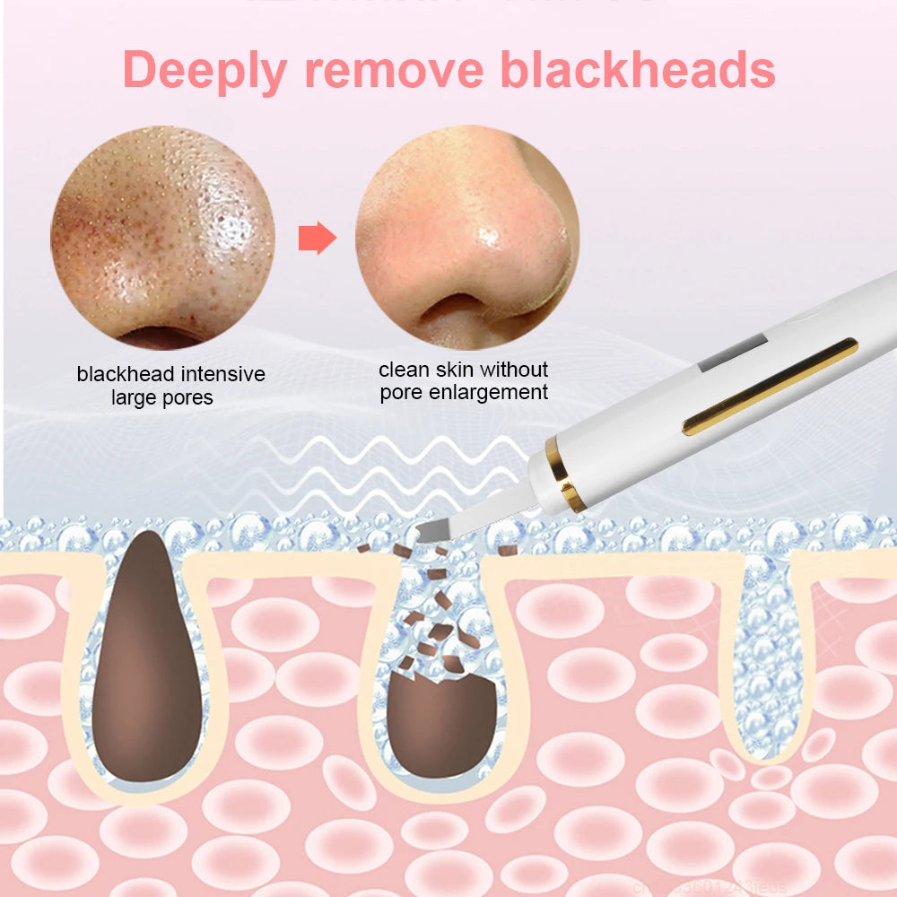 Ultrasonic Electric skin scrubber