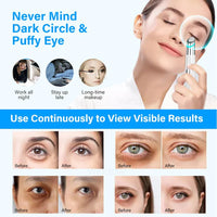 IPL Eye and Face Massager