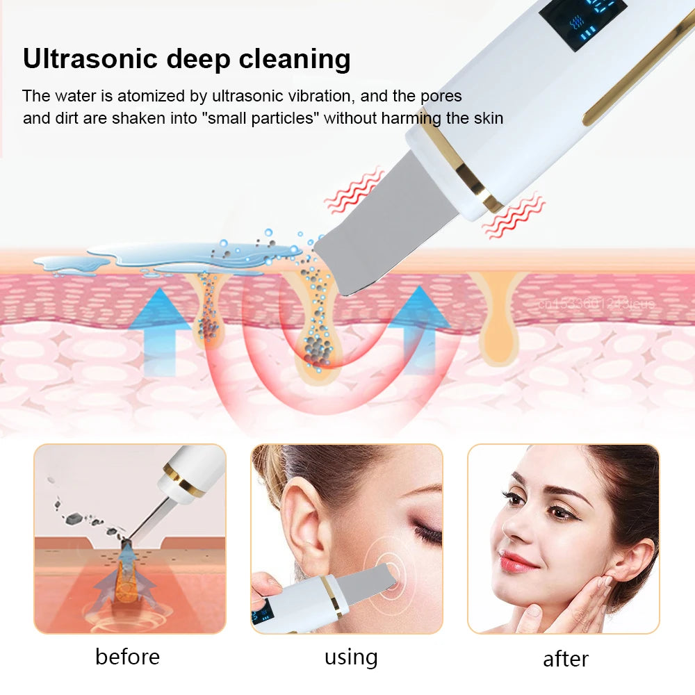 Ultrasonic Electric skin scrubber