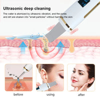 Ultrasonic Electric skin scrubber