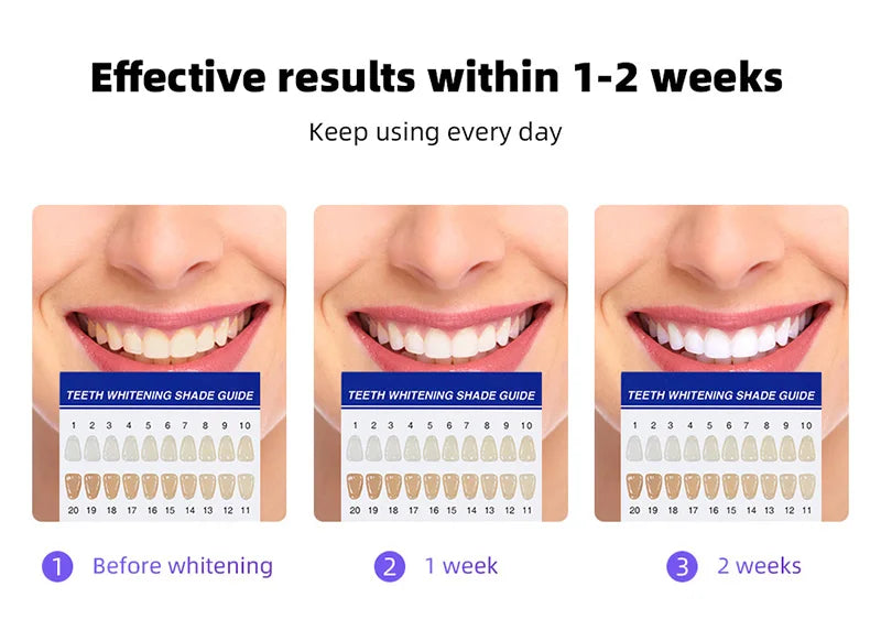 Wireless Teeth Whitening