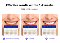 Wireless Teeth Whitening