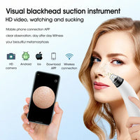 Electric blackhead remover vacuum with camera