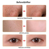 Ultrasonic Electric skin scrubber