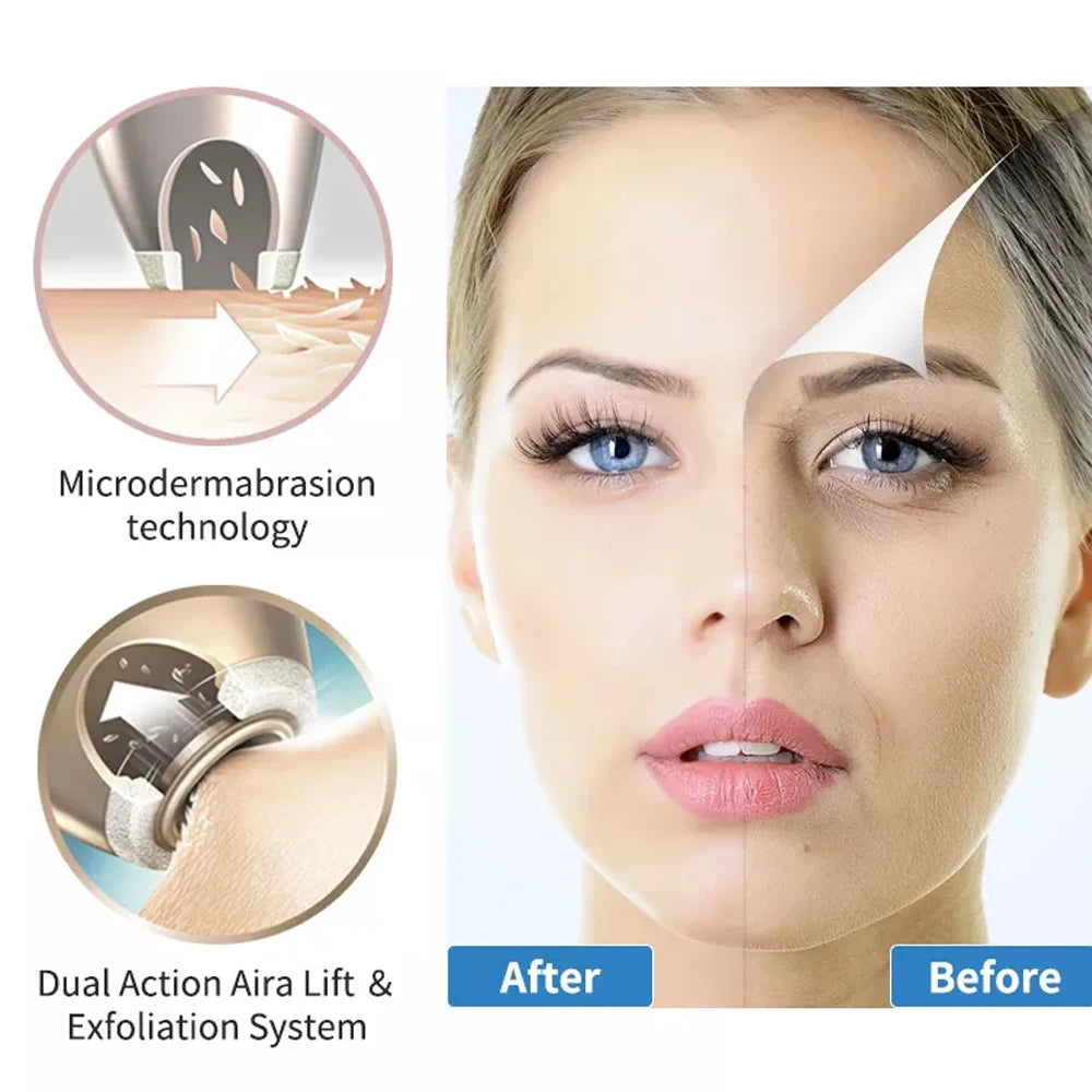Handheld smart microdermabrasion