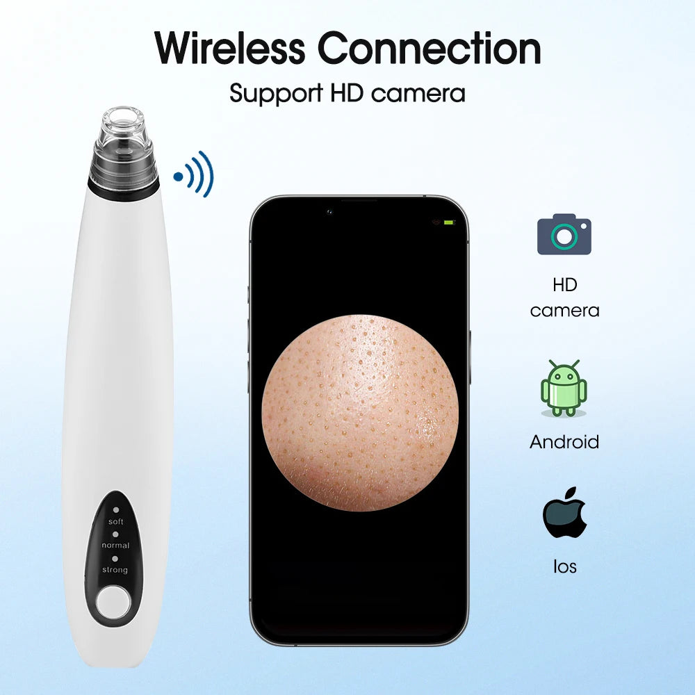 Electric blackhead remover vacuum with camera