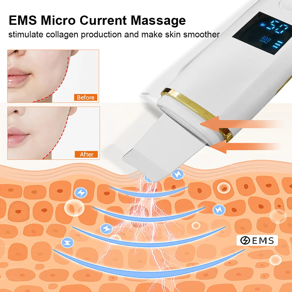 Ultrasonic Electric skin scrubber