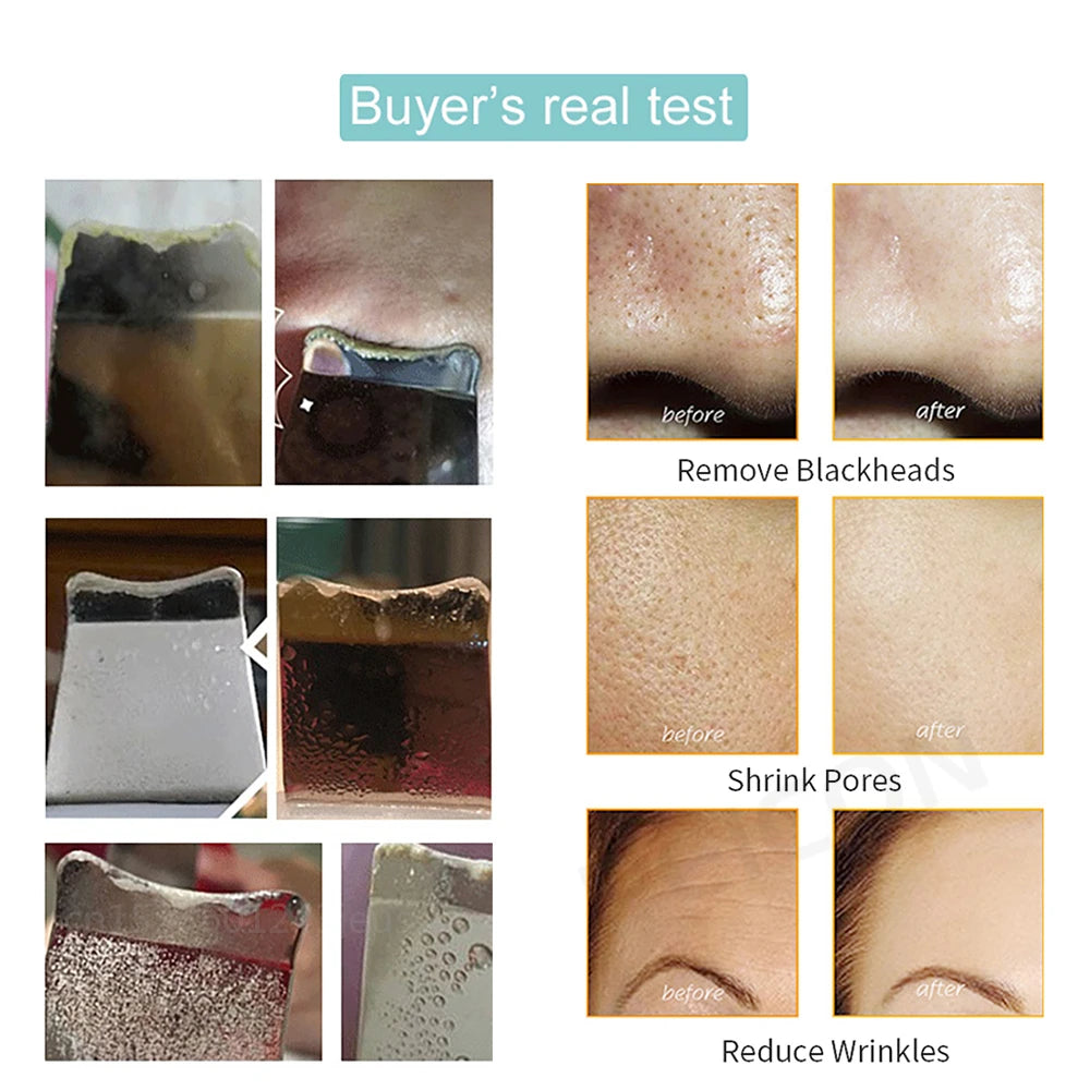 Ultrasonic Electric skin scrubber