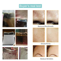 Ultrasonic Electric skin scrubber