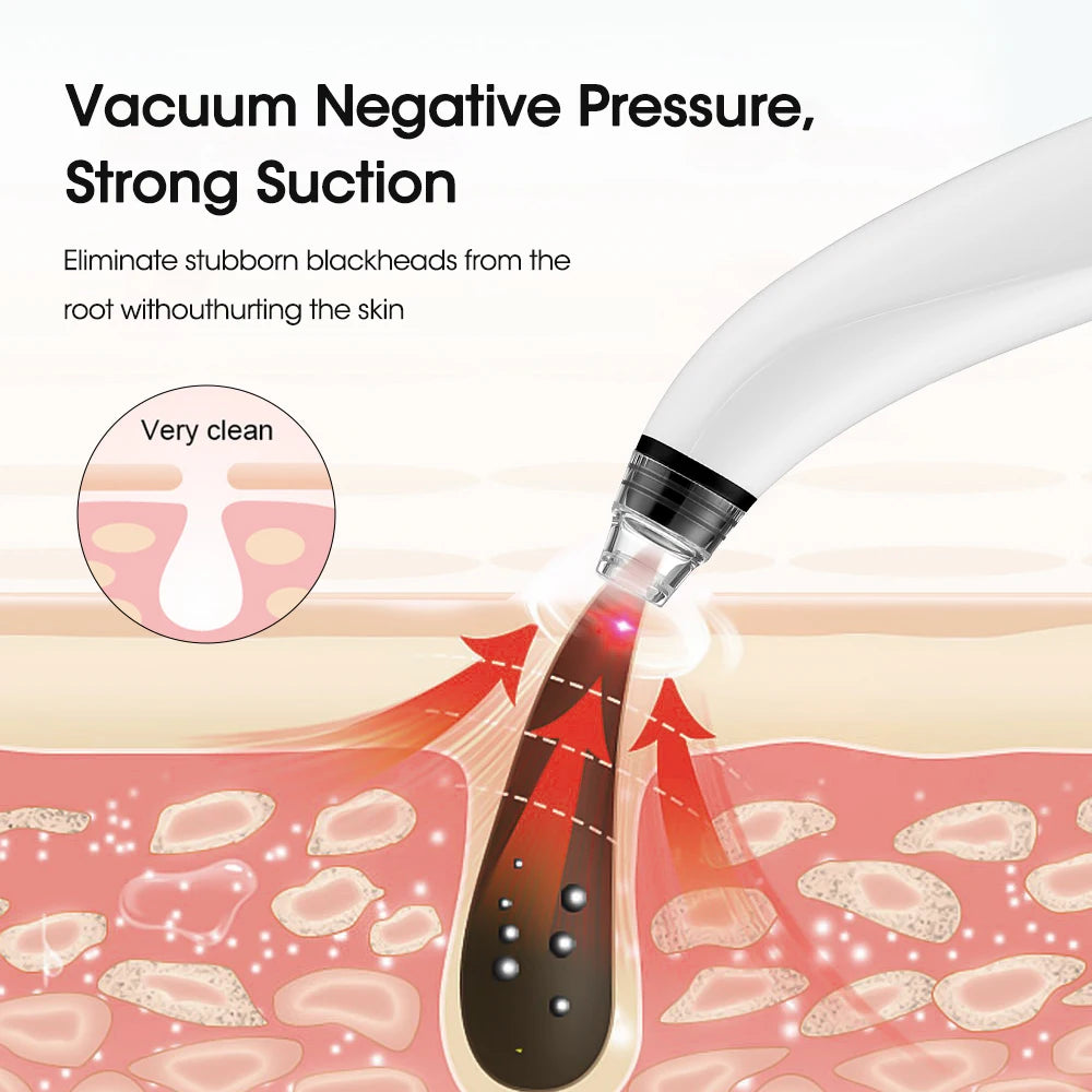 Electric blackhead remover vacuum with camera