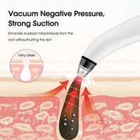 Electric blackhead remover vacuum with camera