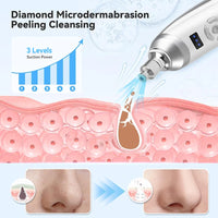 2 in 1 Microdermabrasion blackhead remover device