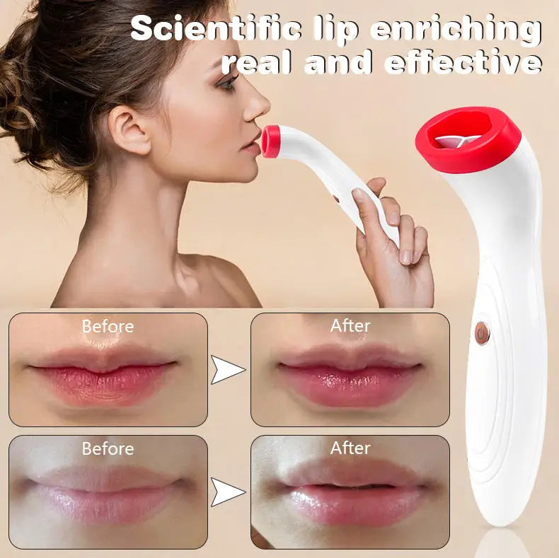 Lip Plumper Device