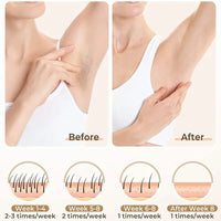 Lumea Hair Removal Device